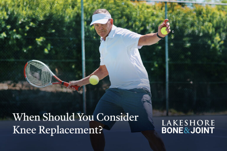 When Should You Consider Knee Replacement Understanding Symptoms, Recovery, and Treatment Options